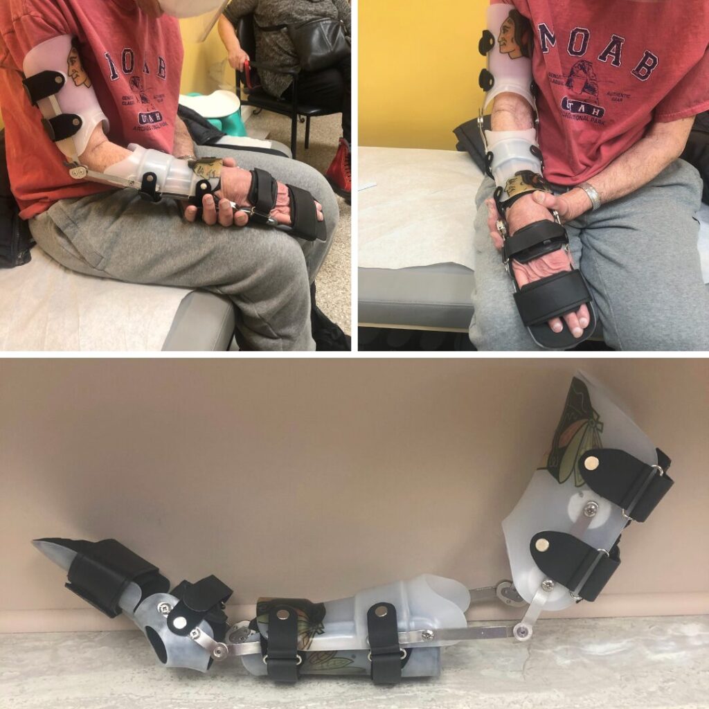 Elbow wrist hand orthosis