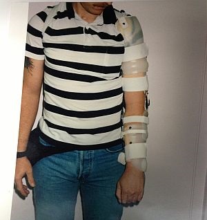 Shoulder orthosis