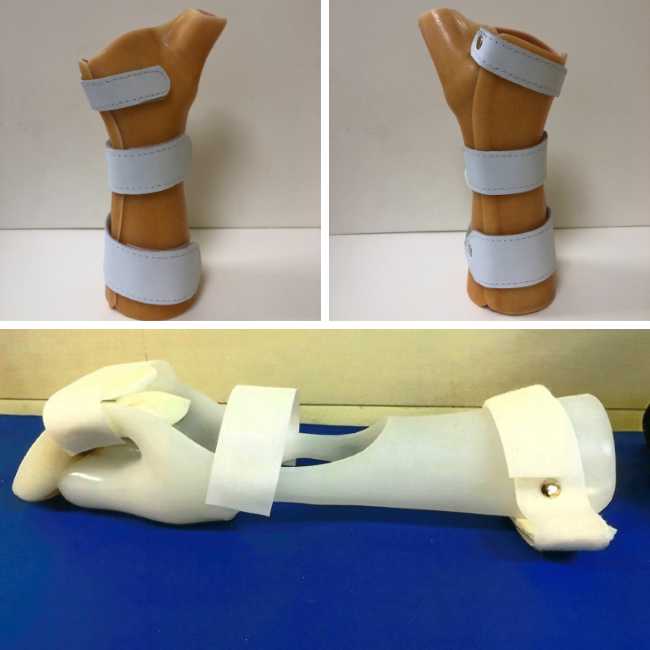Wrist-hand orthoses